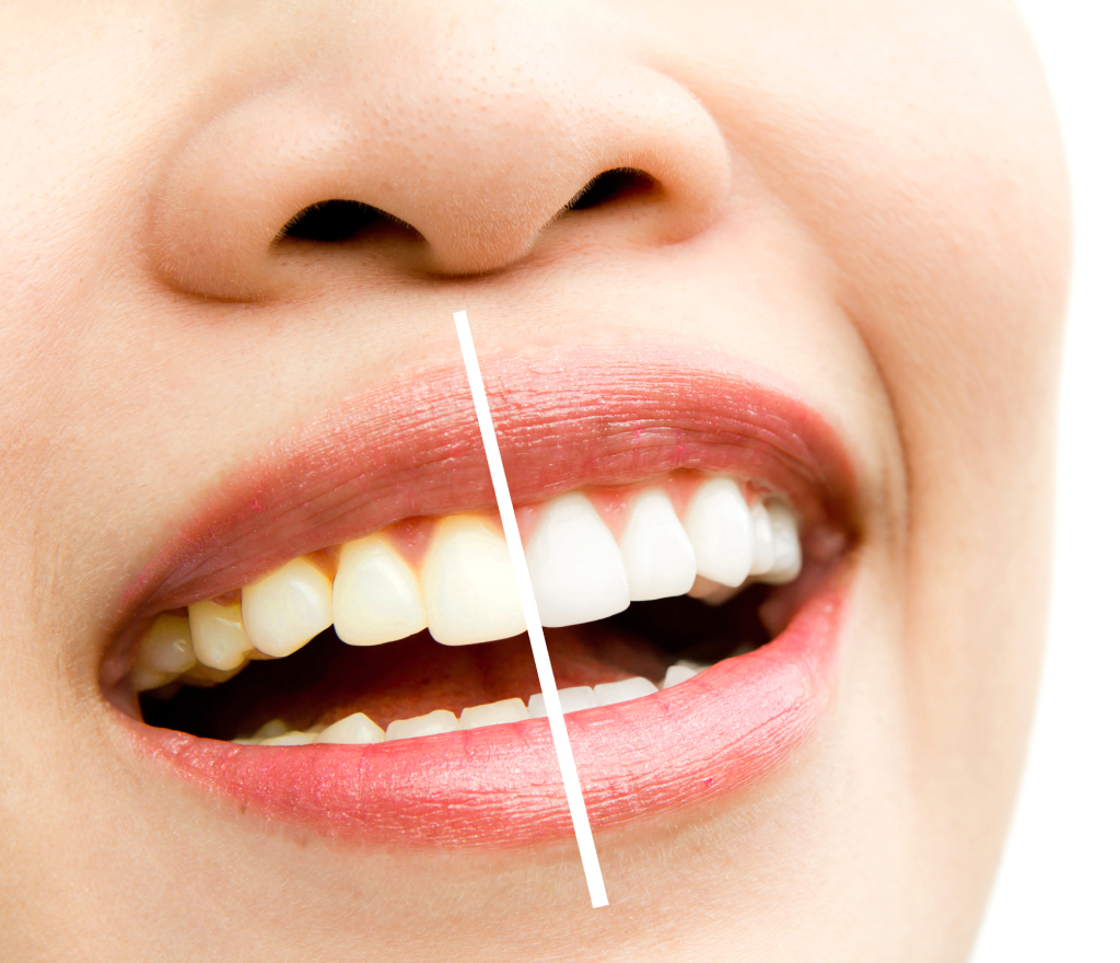 smile-design-specialist-in-gurgaon