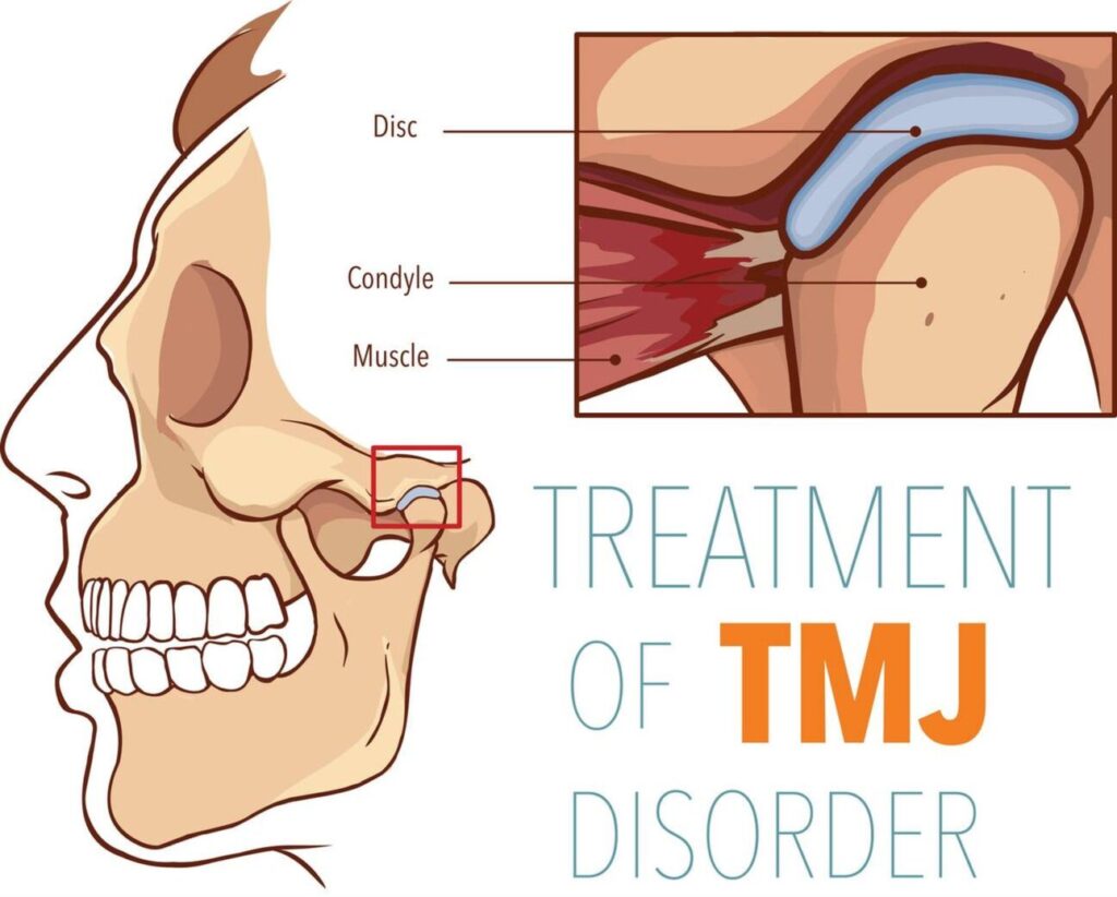 tmj-specialist-in-gurgaon