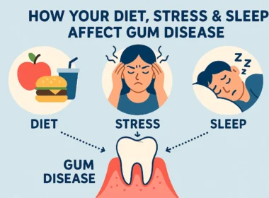How your diet, sleep and food affect your gum dieases