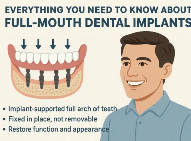 full Mouth Dental Implants