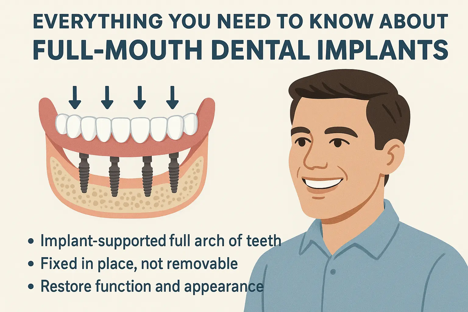 full Mouth Dental Implants
