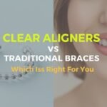 clear aligners vs traditional braces