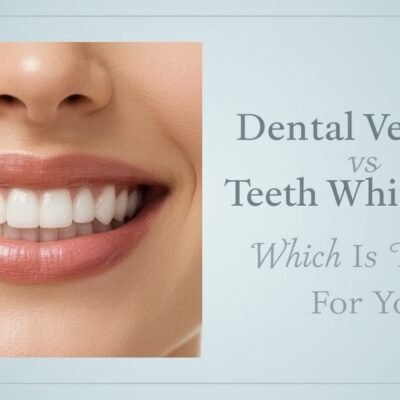 dental veens vs teeth whitening