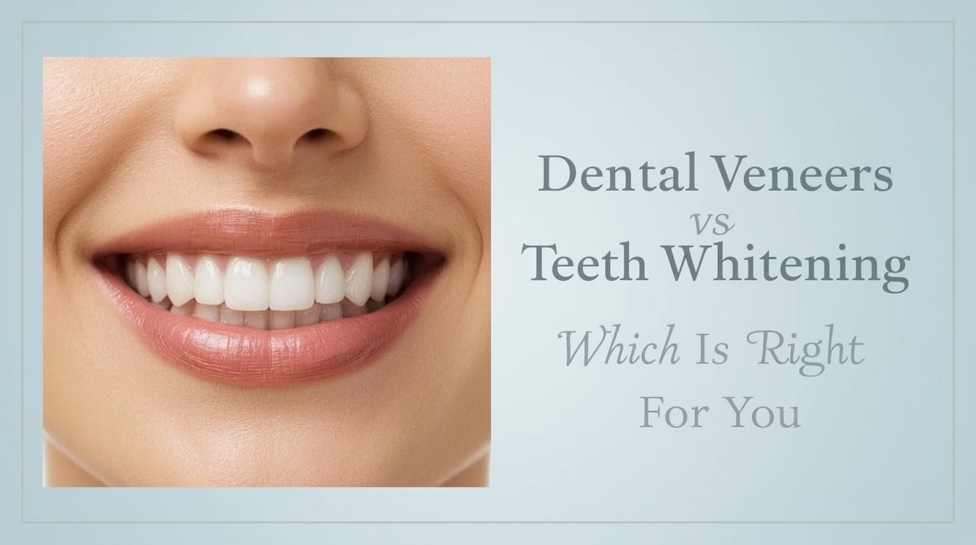 dental veens vs teeth whitening